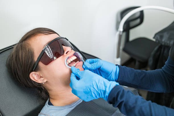 Best Knocked-Out Tooth (Avulsed Tooth) Treatment in Keedysville, MD